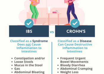 Causes, Symptoms, and Treatment of Crohn’s Disease