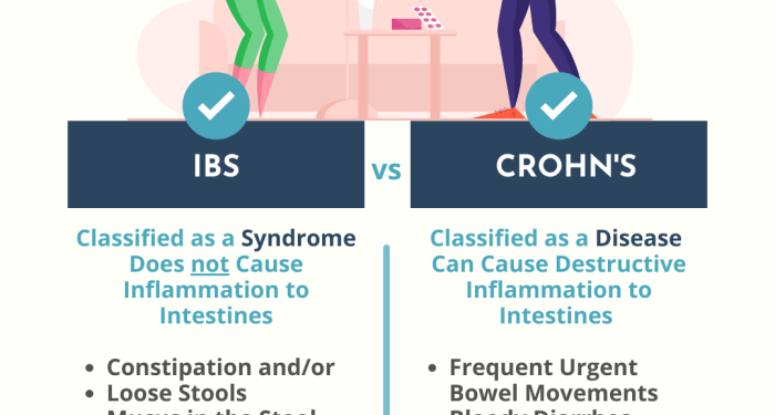 Causes, Symptoms, and Treatment of Crohn’s Disease