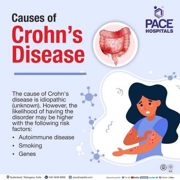 Crohn's Disease Symptoms, Causes, And Treatment Options