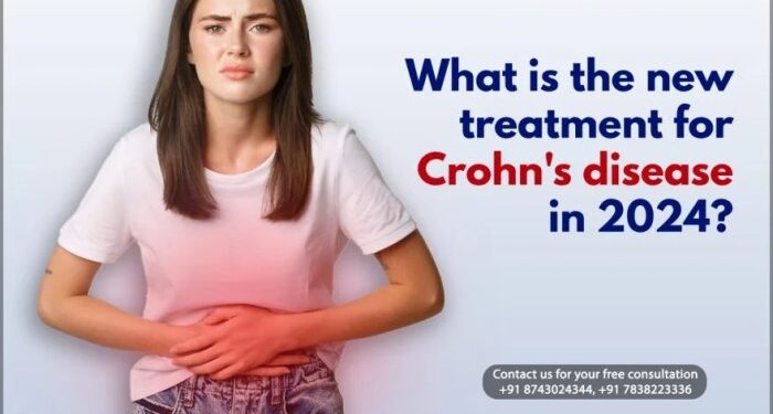 What Is the New Treatment for Crohn’s Disease in 2024?